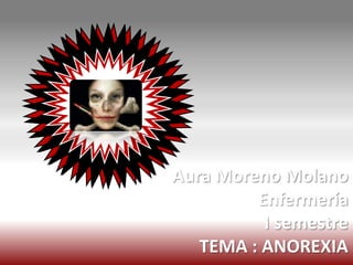 Aura Moreno Molano
         Enfermería
          I semestre
   TEMA : ANOREXIA
 