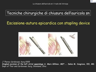 Tecniche chirurgiche di chiusura dell’auricola sn
Escissione-sutura epicardica con stapling device
J Thorac Cardiovasc Sur...