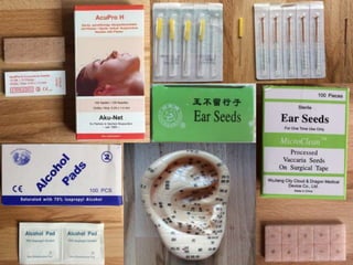 Auricular Acupuncture