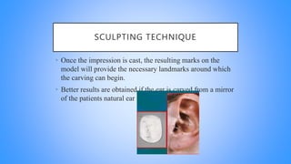 SCULPTING TECHNIQUE
• Once the impression is cast, the resulting marks on the
model will provide the necessary landmarks around which
the carving can begin.
• Better results are obtained if the ear is carved from a mirror
of the patients natural ear
 