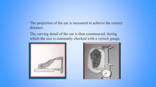 • The projection of the ear is measured to achieve the correct
distance.
• The carving detail of the ear is then commenced, during
which the size is constantly checked with a verneir gauge,
 