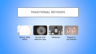 TRADITIONAL METHODS
Spring steel
bands
Double side
adhesive tape
Adhesives Magnet or
clip tetainer
 