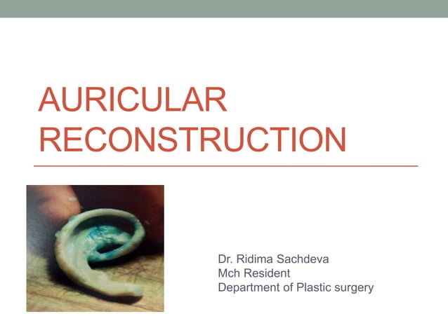 Auricular reconstruction | PPTX