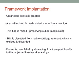 Framework Implantation
• Cutaneous pocket is created
• A small incision is made anterior to auricular vestige
• Thin flap is raised ( preserving subdermal plexus)
• Skin is dissected from native cartilage remnant, which is
excised & discarded
• Pocket is completed by dissecting 1 or 2 cm peripherally
to the projected framework markings
 