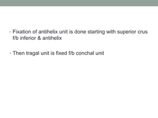 • Fixation of antihelix unit is done starting with superior crus
f/b inferior & antihelix
• Then tragal unit is fixed f/b conchal unit
 