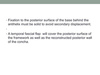 • Fixation to the posterior surface of the base behind the
antihelix must be solid to avoid secondary displacement.
•
• A temporal fascial flap will cover the posterior surface of
the framework as well as the reconstructed posterior wall
of the concha.
 