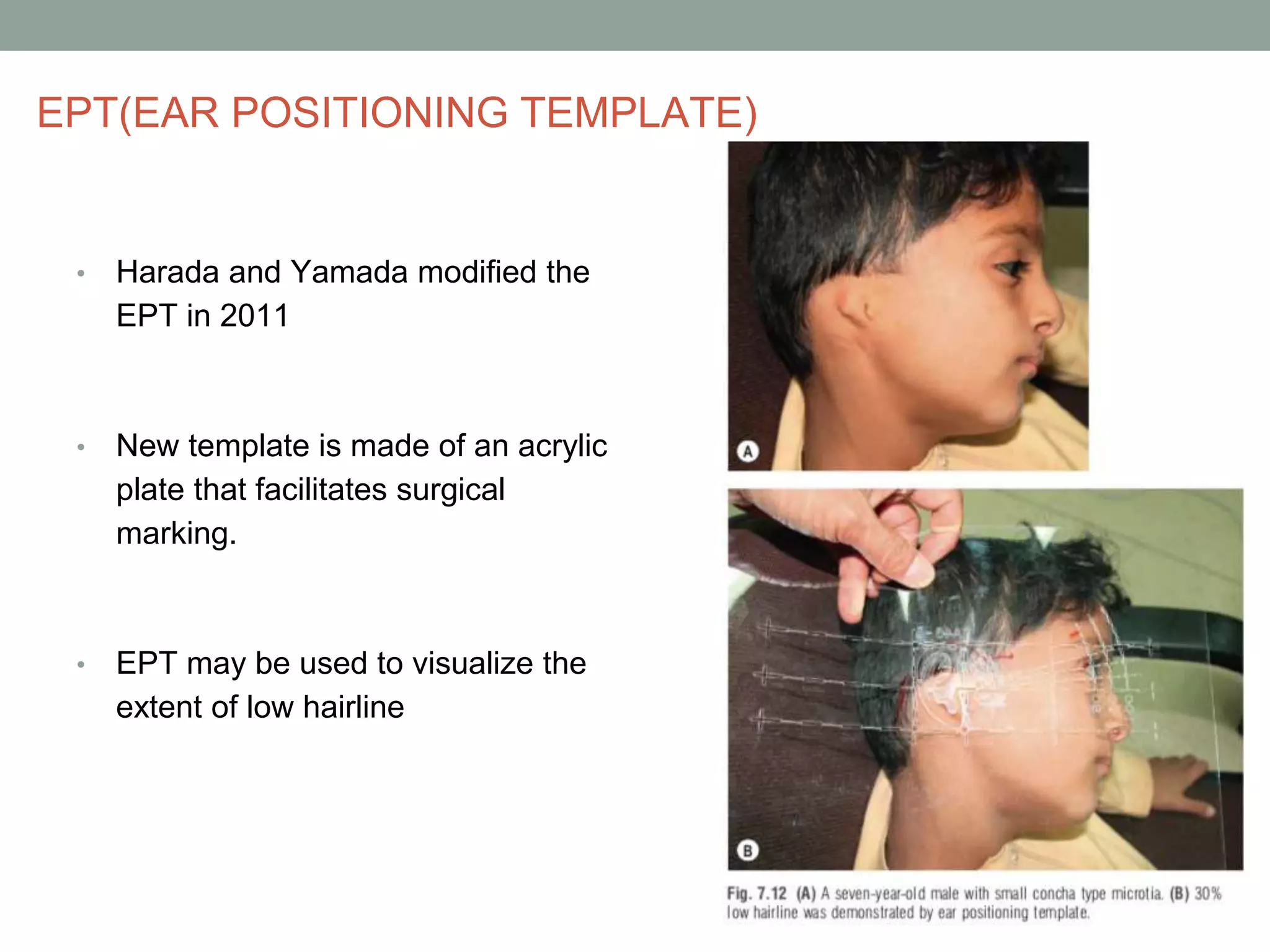 AURICULAR Reconstruction 1.pptx