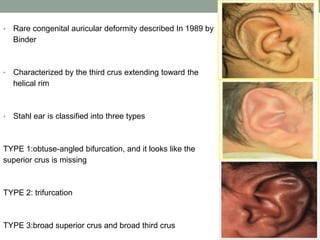 AURICULAR Reconstruction 1.pptx