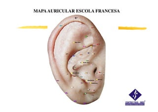 MAPA AURICULAR ESCOLA FRANCESA
 