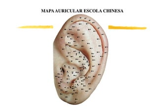 MAPA AURICULAR ESCOLA CHINESA
 