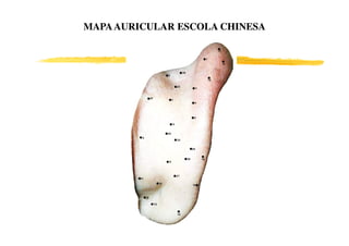 MAPA AURICULAR ESCOLA CHINESA
 