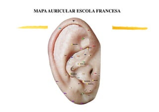 MAPAAURICULAR ESCOLA FRANCESAMAPAAURICULAR ESCOLA FRANCESA
 