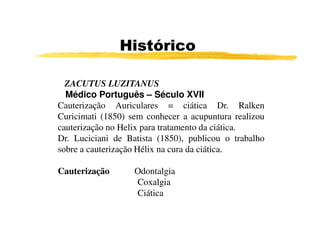 ZACUTUS LUZITANUS
Médico Português – Século XVII
Cauterização Auriculares = ciática Dr. Ralken
Curicimati (1850) sem conhecer a acupuntura realizou
Histórico
Curicimati (1850) sem conhecer a acupuntura realizou
cauterização no Helix para tratamento da ciática.
Dr. Luciciani de Batista (1850), publicou o trabalho
sobre a cauterização Hélix na cura da ciática.
Cauterização Odontalgia
Coxalgia
Ciática
 