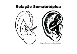 Relação Somatotópica
Imagem do feto no pavilhão auricular
 
