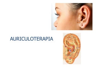 AURICULOTERAPIA
 