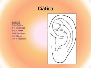 Ciática
PUNTOS
96.- Ciática
94.- Lumbago
98.- Cadera
20.- Shenmen
35.- Riñón
79.- Subcortex
96
20
79
35
94
98
 