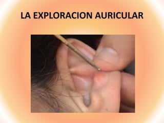 LA EXPLORACION AURICULAR
 
