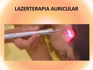 LAZERTERAPIA AURICULAR
 