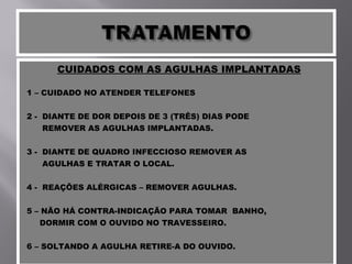CUIDADOS COM AS AGULHAS IMPLANTADAS 1 – CUIDADO NO ATENDER TELEFONES 2 -  DIANTE DE DOR DEPOIS DE 3 (TRÊS) DIAS PODE  REMOVER AS AGULHAS IMPLANTADAS. 3 -  DIANTE DE QUADRO INFECCIOSO REMOVER AS AGULHAS E TRATAR O LOCAL. 4 -  REAÇÕES ALÉRGICAS – REMOVER AGULHAS. 5 – NÃO HÁ CONTRA-INDICAÇÃO PARA TOMAR  BANHO,  DORMIR COM O OUVIDO NO TRAVESSEIRO. 6 – SOLTANDO A AGULHA RETIRE-A DO OUVIDO. 