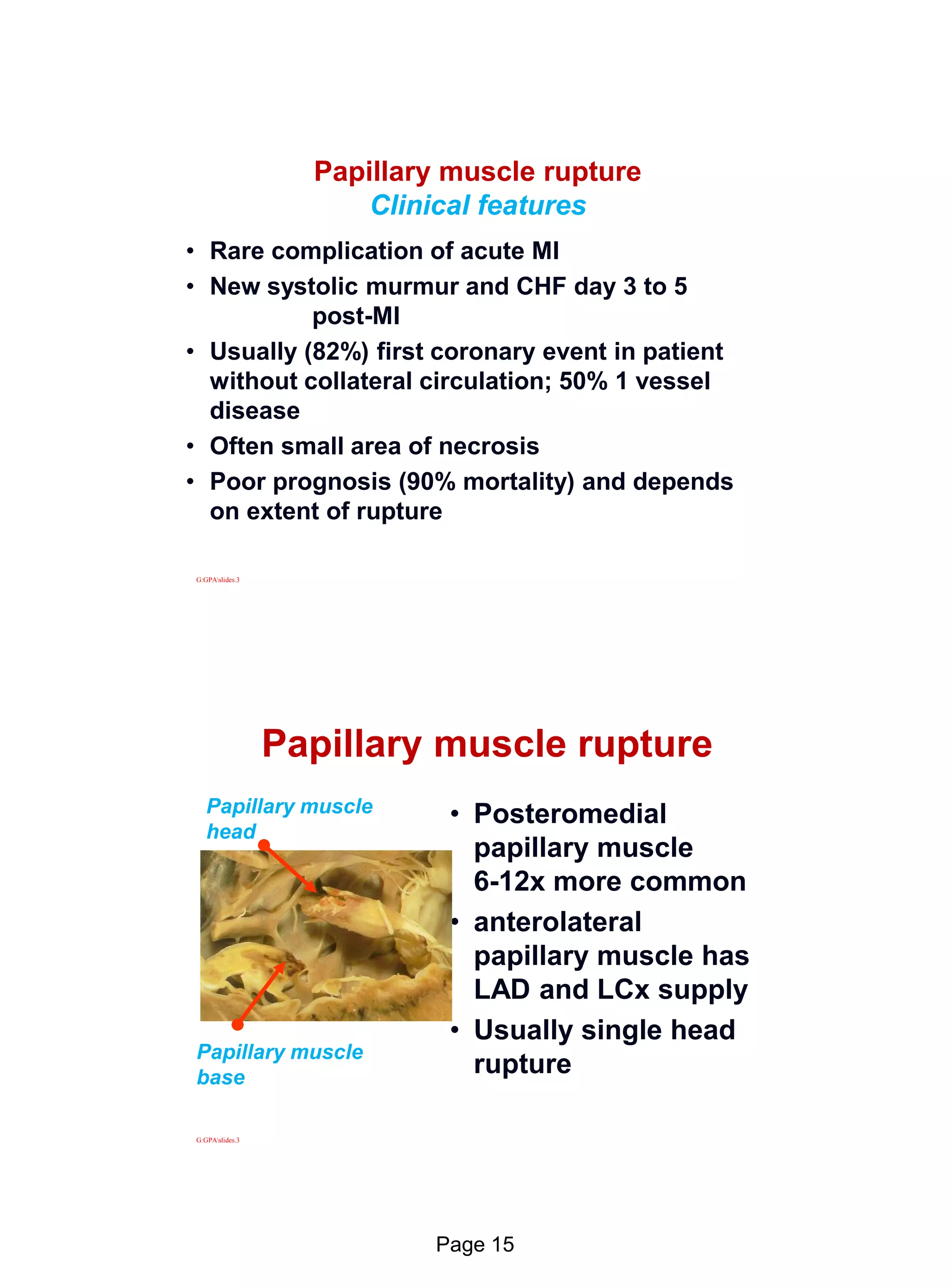 Echo in ischaemic heart disease and Myocardial infarction | PDF