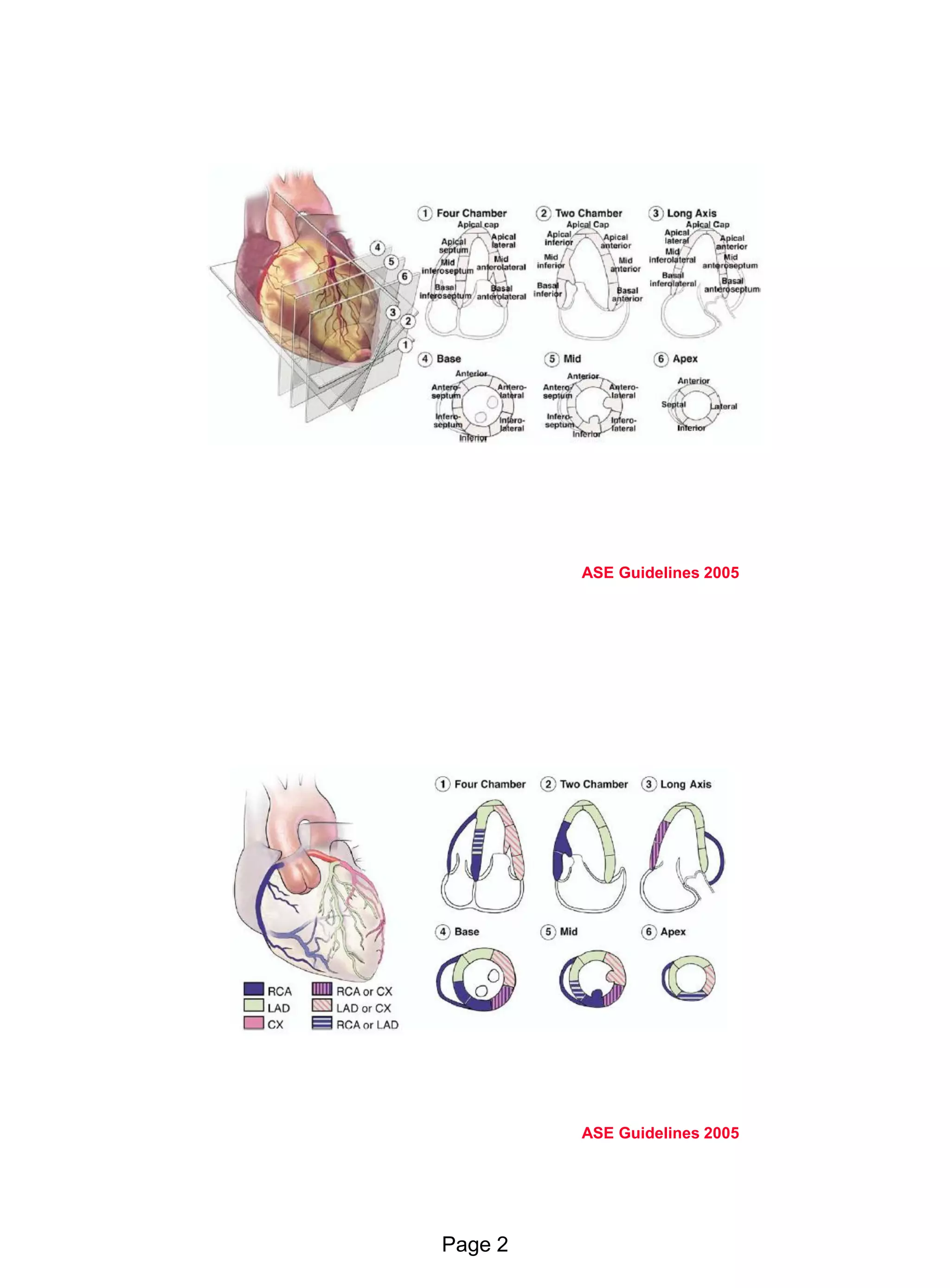 Echo in ischaemic heart disease and Myocardial infarction | PDF