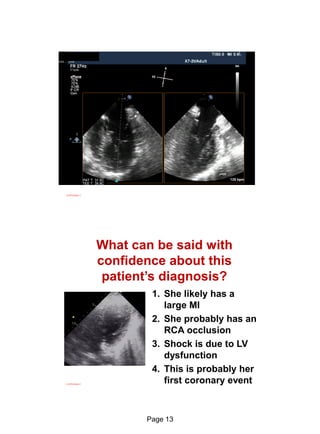 Echo in ischaemic heart disease and Myocardial infarction | PDF