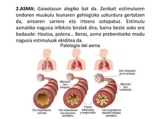 2.ASMA: Gaixotasun alegiko bat da. Zenbait estimuluren
ondoren muskulu leunaren gehiegizko uzkurdura gertatzen
da, airearen sarrera eta irteera oztopatuz. Estimulu
asmatiko nagusia infekzio biralak dira, baina beste asko ere
badaude: Hautsa, polena… Beraz, asma prebenitzeko modu
nagusia estimuluak ekiditea da.
 