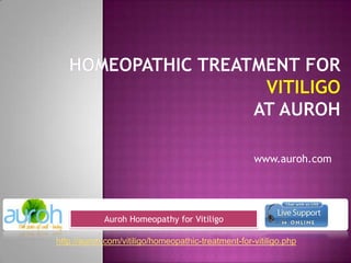 Homeopathic Treatment forVitiligoat Auroh www.auroh.com Auroh Homeopathy for Vitiligo http://auroh.com/vitiligo/homeopathic-treatment-for-vitiligo.php 