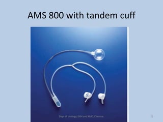 AMS 800 with tandem cuff
21
Dept of Urology, GRH and KMC, Chennai.
 