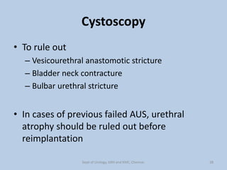 Cystoscopy
• To rule out
– Vesicourethral anastomotic stricture
– Bladder neck contracture
– Bulbar urethral stricture
• In cases of previous failed AUS, urethral
atrophy should be ruled out before
reimplantation
28
Dept of Urology, GRH and KMC, Chennai.
 