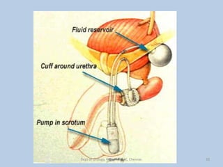 33
Dept of Urology, GRH and KMC, Chennai.
 