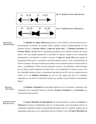 12
RODADOS DE
ORIGEM MITRAL
RODADOS
TRICÚSPIDES
S. DIASTÓLICOS DE
REGURGITAÇÃO
Os Rodados de origem Mitral pesquisam-se no Foco Mitral e são mais intensos com o
posicionamento do Doente em decúbito lateral esquerdo. Existem fundamentalmente em três
situações clínicas: 1) Estenose Mitral; 2) Sopro de Austin Flint; e 3) Rodados Funcionais. Na
Estenose Mitral o Rodado Mitral é geralmente precedido por um estalido de abertura da válvula
mitral e tem uma duração proporcional à gravidade da estenose: quando só tem componentes
protodiastólico e préssistólico a estenose é discreta. O Sopro de Austin Flint surge quando há
regurgitação aórtica grave: o enchimento ventricular diastólico precoce é feito simultaneamente da
aurícula esquerda e da aorta ascendente provocando um encerramento parcial da válvula mitral na
meso- e na telediástole. O fluxo aurículo-ventricular na meso- e na telediástole é então efectuado
por um orifício estreito originando um Sopro Meso- e/ou Telediastólico. O Sopro de Austin Flint
tem intensidade máxima no ápex, é normalmente precedido por um S3 e não se acompanha por um
reforço de S1. Os Rodados Funcionais, por sua vez, têm origem num fluxo A-V diastólico
exagerado por um orifício de dimensões normais (e.g. Rodado Funcional Mitral na Insuficiência
Mitral).
Os Rodados Tricúspides têm intensidade máxima no Foco Tricúspide e aumentam a sua
intensidade com a inspiração. Podem ser devidos a Estenose Tricúspide ou ser Funcionais (e.g.
Comunicação Interauricular).
Os Sopros Diastólicos de Regurgitação são de alta frequência e podem ser Aórticos ou
Pulmonares. Iniciam-se imediatamente após S2, em decrescendo e têm uma duração variável: na
regurgitação moderada a duração é longa podendo prolongar-se até ao S1 seguinte, enquanto que na
regurgitação aguda grave ou na regurgitação discreta a duração é curta. Os Sopros Diastólicos de
Fig. 14 - Rodado (Estenose Mitral discreta).
Fig. 15 - Rodado (Estenose Mitral grave).
 