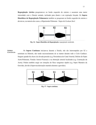 13
SOPROS
CONTÍNUOS
Regurgitação Aórtica pesquisam-se no bordo esquerdo do esterno e assumem uma maior
intensidade com o Doente sentado, inclinado para diante e em expiração forçada. Os Sopros
Diastólicos de Regurgitação Pulmonares também se pesquisam no bordo esquerdo do esterno e
devem-se, na maioria dos casos, a Hipertensão Pulmonar - Sopro de Graham Steel.
Os Sopros Contínuos iniciam-se durante a Sístole, não são interrompidos por S2 e
terminam na Diástole, não tendo necessariamente de se manter durante todo o Ciclo Cardíaco.
Surgem quando há shunts de elevada pressão (e.g. Persistência do Canal Arterial, Defeito do Septo
Aorto-Pulmonar, Fístulas Arterio-Venosas) e na obstrução arterial localizada (e.g. Coartacção da
Aorta). Podem também surgir em situações de fluxo sanguíneo rápido (e.g. Sopro Mamário da
Gravidez, devido à hipervascularização mamária durante a gravidez).
Fig. 16 - Sopro Diastólico de Regurgitação: regurgitação moderada.
Fig. 17 - Sopro contínuo.
 