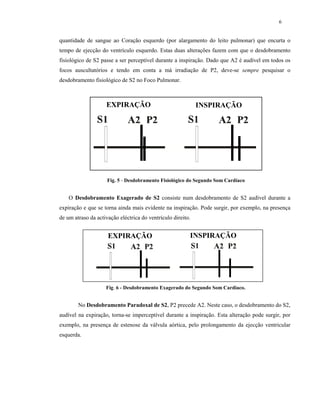 6
quantidade de sangue ao Coração esquerdo (por alargamento do leito pulmonar) que encurta o
tempo de ejecção do ventrículo esquerdo. Estas duas alterações fazem com que o desdobramento
fisiológico de S2 passe a ser perceptível durante a inspiração. Dado que A2 é audível em todos os
focos auscultatórios e tendo em conta a má irradiação de P2, deve-se sempre pesquisar o
desdobramento fisiológico de S2 no Foco Pulmonar.
O Desdobramento Exagerado de S2 consiste num desdobramento de S2 audível durante a
expiração e que se torna ainda mais evidente na inspiração. Pode surgir, por exemplo, na presença
de um atraso da activação eléctrica do ventrículo direito.
No Desdobramento Paradoxal de S2, P2 precede A2. Neste caso, o desdobramento do S2,
audível na expiração, torna-se imperceptível durante a inspiração. Esta alteração pode surgir, por
exemplo, na presença de estenose da válvula aórtica, pelo prolongamento da ejecção ventricular
esquerda.
Fig. 5 - Desdobramento Fisiológico do Segundo Som Cardíaco
Fig. 6 - Desdobramento Exagerado do Segundo Som Cardíaco.
EXPIRAÇÃO INSPIRAÇÃO
EXPIRAÇÃO INSPIRAÇÃO
 