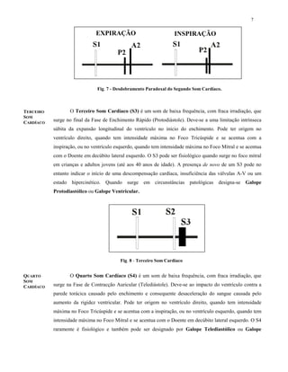 7
O Terceiro Som Cardíaco (S3) é um som de baixa frequência, com fraca irradiação, que
surge no final da Fase de Enchimento Rápido (Protodiástole). Deve-se a uma limitação intrínseca
súbita da expansão longitudinal do ventrículo no início do enchimento. Pode ter origem no
ventrículo direito, quando tem intensidade máxima no Foco Tricúspide e se acentua com a
inspiração, ou no ventrículo esquerdo, quando tem intensidade máxima no Foco Mitral e se acentua
com o Doente em decúbito lateral esquerdo. O S3 pode ser fisiológico quando surge no foco mitral
em crianças e adultos jovens (até aos 40 anos de idade). A presença de novo de um S3 pode no
entanto indicar o início de uma descompensação cardíaca, insuficiência das válvulas A-V ou um
estado hipercinético. Quando surge em circunstâncias patológicas designa-se Galope
Protodiastólico ou Galope Ventricular.
O Quarto Som Cardíaco (S4) é um som de baixa frequência, com fraca irradiação, que
surge na Fase de Contracção Auricular (Telediástole). Deve-se ao impacto do ventrículo contra a
parede torácica causado pelo enchimento e consequente desaceleração do sangue causada pelo
aumento da rigidez ventricular. Pode ter origem no ventrículo direito, quando tem intensidade
máxima no Foco Tricúspide e se acentua com a inspiração, ou no ventrículo esquerdo, quando tem
intensidade máxima no Foco Mitral e se acentua com o Doente em decúbito lateral esquerdo. O S4
raramente é fisiológico e também pode ser designado por Galope Telediastólico ou Galope
EXPIRAÇÃO INSPIRAÇÃO
Fig. 7 - Desdobramento Paradoxal do Segundo Som Cardíaco.
Fig. 8 - Terceiro Som Cardíaco
TERCEIRO
SOM
CARDÍACO
QUARTO
SOM
CARDÍACO
 