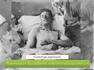 Mustard gas experiments
เป็นทหารแคนนาดา ที่ถูกแก๊สมัสทาร์ท จะเห็นว่าเกิดบาดแผลพรุพองทั่วร่างกาย
 