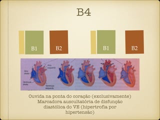 B4
B2
Ouvida na ponta do coração (exclusivamente)
Marcadora auscultatória de disfunção
diastólica do VE (hipertrofia por
hipertensão)
B1 B2B1
 