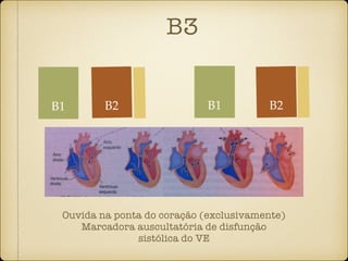 B3
B2
Ouvida na ponta do coração (exclusivamente)
Marcadora auscultatória de disfunção
sistólica do VE
B1 B2B1
 