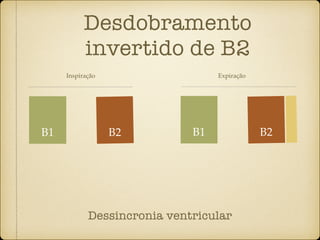 Desdobramento
invertido de B2
B1 B2
Dessincronia ventricular
B1 B2
Inspiração Expiração
 