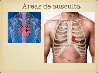 Áreas de ausculta
 