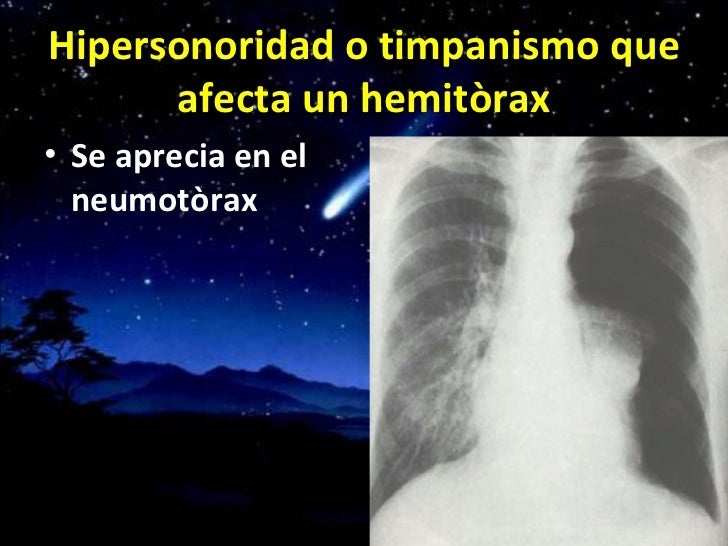 Auscultaciòn pulmonar