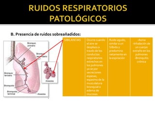 B. Presencia de ruidos sobreañadidos:
SIBILANCIAS Ocurre cuando
el aire se
desplaza a
través de los
conductos
respiratorios
estrechos en
los pulmones
ya se por
secreciones
espesas,
espasmo de la
musculatura
bronquial o
edema de
mucosas
Ruido agudo,
similar a un
Silbido y
predomina
netamente en
la espiración
-Asma
-Inhalación de
un cuerpo
extraño en los
pulmones
-Bronquitis
crónica
 