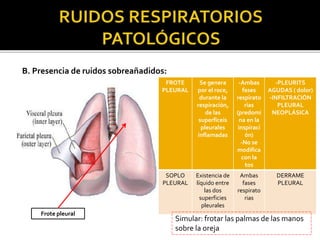B. Presencia de ruidos sobreañadidos:
Frote pleural
FROTE
PLEURAL
Se genera
por el roce,
durante la
respiración,
de las
superficeis
pleurales
inflamadas
-Ambas
fases
respirato
rias
(predomi
na en la
inspiraci
ón)
-No se
modifica
con la
tos
-PLEURITS
AGUDAS ( dolor)
-INFILTRACIÓN
PLEURAL
NEOPLÁSICA
SOPLO
PLEURAL
Existencia de
líquido entre
las dos
superficies
pleurales
Ambas
fases
respirato
rias
DERRAME
PLEURAL
Simular: frotar las palmas de las manos
sobre la oreja
 