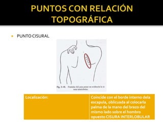  PUNTOCISURAL
Localización: Coincide con el borde interno dela
escapula, oblicuada al colocarla
palma de la mano del brazo del
mismo lado sobre el hombro
opuesto CISURA INTERLOBULAR
 