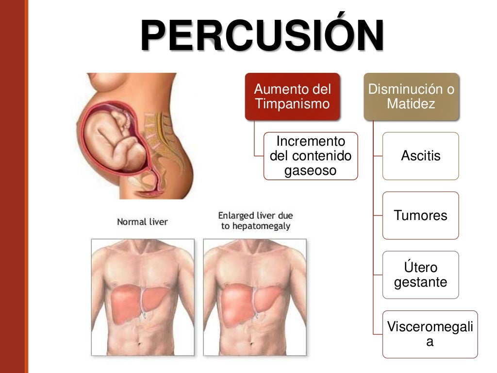 Auscultación y Percusión Abdominal