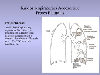 Ruidos respiratorios Accesorios: Frotes Pleurales Frotes Pleurales:  Sonido, bajo inspiratorio y espiratorio, discontinuo, se modifica con la presión local, doloroso, desaparece con el derrame pleural,causas. Pleuresía seca o 2º a TBC,neumonía, neoplasia, etc.  