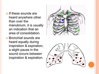  If these sounds are 
heard anywhere other 
than over the 
manubrium, it is usually 
an indication that an 
area of consolidation. 
 Bronchial sounds are 
heard equally during 
inspiration & expiration; 
a slight pause in the 
sound occurs between 
inspiration & expiration. 
 