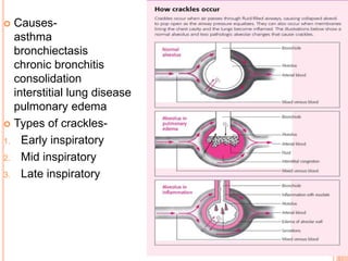  Causes-asthma 
bronchiectasis 
chronic bronchitis 
consolidation 
interstitial lung disease 
pulmonary edema 
 Types of crackles- 
1. Early inspiratory 
2. Mid inspiratory 
3. Late inspiratory 
 