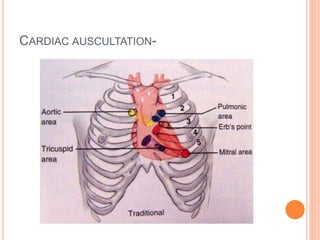 CARDIAC AUSCULTATION- 
 