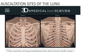 AUSCALTATION SITES OF THE LUNG
 